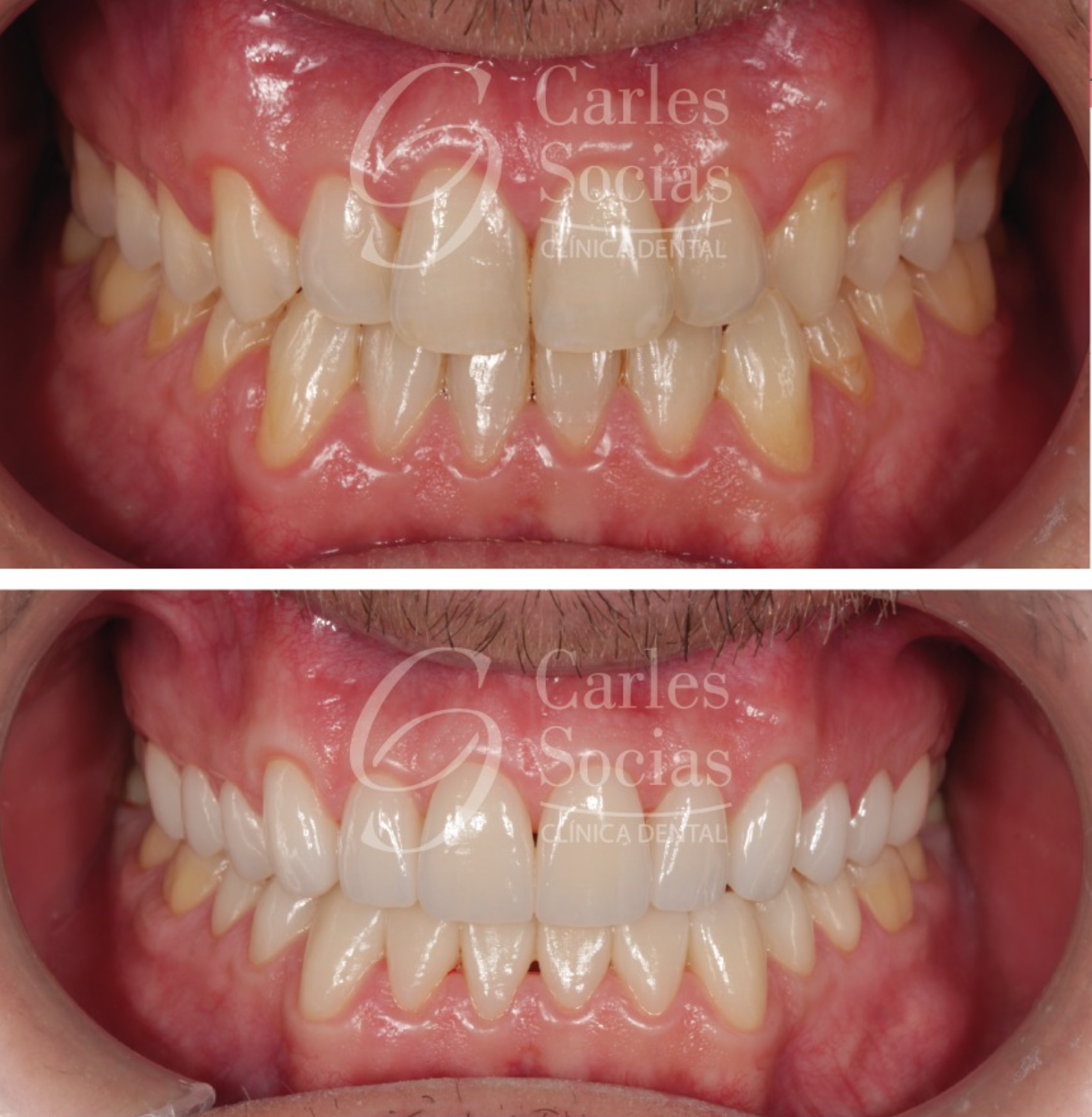 (DSD) Diseño de Sonrisa Digital